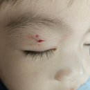 나눔약국 | 미추홀구응급실:: 더나눔병원 아기상처 봉합가능병원 후기