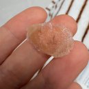 양산강남의원 | 흑자 전문병원, 예젤의원 흑자제거 후기