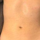 최프로 스킨 앤 바디 이미지