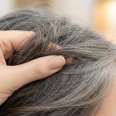 “나이 먹었나” 속상했는데…흰머리 없으면 ‘암 위험’ 커진다고? 이미지