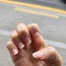 클린풋 | 문래동 네일, 손톱교정, 발톱교정 - 네일바다 닥터풋클린, 후기