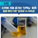 소변에 거품 생기는 ‘단백뇨’ 종류 이미지