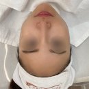 미더베스트 부천점 | 부천피부관리 미더베스트 부천점 퍼펙트케어 후기