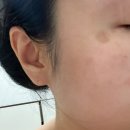 예젤의원 | 예젤의원 방문후기 3탄_흑자 다시 되살아나다?!