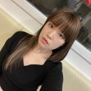 압구정 리프팅 / &#39;미랩클리닉&#39; 에서 히든브이주사 받은 후기! (3차 시술 후 한달 경과)