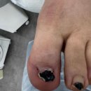 UR(의정부시)-[평화로]-상-220 | 의정부레푸스 앤 두두뷰티에 다녀온 솔직 후기예요