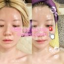 건조피부 오투덤산소테라피 후기! 풍무동 피부관리 로이나뷰티 스킨케어 김포풍무점