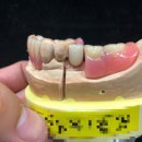 참진치과기공소 이미지