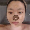 아름라인에스테틱 | 자양동 피부관리 : 여드름관리 제대로 받고왔어요!! 아름라인에스테틱