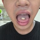 고함량 알부민 추천 간단하게 복용 헬씨라이프 알부민 플러스 알파 고함량 난백 단백질 후기!!!