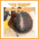 씨유 이서점 | 아산두피관리 두피케어 반한뷰티 정수리 탈모관리 후기
