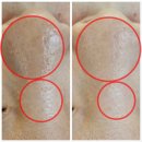신풍마을회관 | 신풍역 피부관리 해움에스테틱 세멘시트 모공관리 물방울 리프팅 관리후기