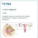 FTM 자궁적출술]FTM에서의 자궁적출술이란? 이미지