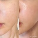 ㈜대웅 | 모공줄이는법 붙이는 모공패치로! 나비존과 코를 한 번에! 이지덤 모공패치 신제품 후기
