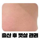 팬지 - 통영시 중앙로 257-1 | 청라에스테틱 뷰티팬지 에스테틱 복부 슬리밍 관리 후기