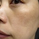 선크림 30개 넘게 써보고 정착한 블랑큐라 톤업선크림 후기