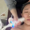 평택윤곽관리 잘하는 곳 선새김에스테틱 윤곽술 후기
