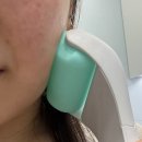청량리 아비쥬의원 사각턱 보톡스 하이톡스 내돈내산 솔직후기