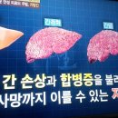 지방간 치료사례,우유.치즈.타락죽/천기누설/기수련/기치료/자연요법/대체의학 이미지