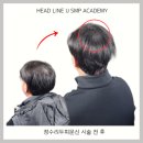 두성식품 | 울산탈모두피문신 시술의 부작용과 안전하게 받기위해서 필요한 것