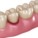 365아홉가지약속치과병원 | 아산치과 자신감 되찾는 생활밀착형 진료 이야기 365아홉가지약속치과병원