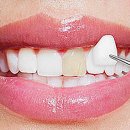 루시드치과기공소 이미지