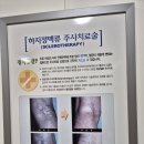 하정빌딩 | 광주에 하지정맥류 잘보는 전문병원 &#39;서울 하정외과&#39; 수술후기