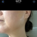 뷰티디바이스 홈케어기기 집 할로 ZIIP HALO - 한달 찐후기 (쿠폰)
