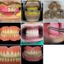 연 치과기공소 이미지