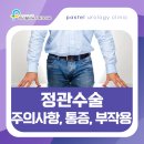 이비뇨기과의원 | 정관수술 후기보다 중요한 주의사항과 통증 부작용 총정리 | 은평비뇨기과
