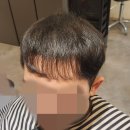 수원 머리숱없는 남자 여자 앞머리 헤어 증모술 와이앤제이 가격