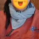 고창제일가정의학과의원 | 인천 편평사마귀 성지 이삭가정의학과 편평사마귀제거 일주일 후기/관리방법