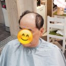 김호증모가발춘천체인점 이미지
