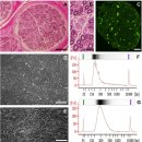 Re: blood nerve barrier--＞말초신경염증 --＞ 대식세포 침투, 약물침투 등 가능 2017 네이처!! 이미지