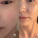 춘천로17번길 | 춘천 피부관리로 찐 추천 '힌즈에스테틱 춘천온의점' 재방문 후기