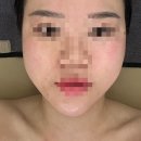 메디플렉스 | 수원역피부관리 잘하는 리메디스킨, 원장님이 근육에 진심인 곳 (위치/가격 정보)