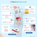 [건강이슈] 먹방 유튜버 줄줄이 사망… 몸 ‘이렇게’ 병들어 갔을 것 이미지