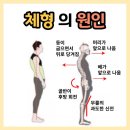 제이엘피트니스 다대점 | [제이엘피트니스장림점]굽은등,허리디스크,골반 후방경사란?골반 후방경사 교정하기!