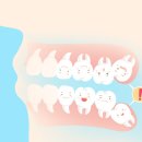 진주신경과의원 | 진주 치과 사랑니 발치, 미루면 안 되는 이유는?