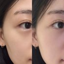 얼굴경락 잘하는 곳 추천 ! 위뷰티 발사지 후기 :)