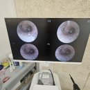 소리보청기 이미지