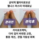 카이로운동센타 | 공덕역 체형 교정 – 허리·어깨 통증 잡고 다리 길이까지 교정된 &#39;웰카이로모션&#39; 후기