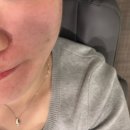 대도사우나 | 물광주사 스킨부스터 효과, 통증 가격 속건조 해결 5cc 후기