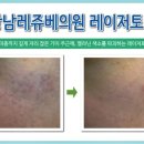 강남레쥬베의원 이미지