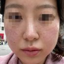 베스트피부과의원 | [강남 유픽 의원 피부과] 첫 방문 - 실제시술 스킨보톡스,가격,원장쌤까지 리얼 후기!