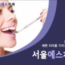 S(에스) 이미지