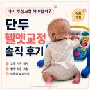 오늘머리할까(?) | 아기 두상교정 해야 할까? 단두 헬멧교정 솔직 후기