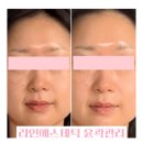 [까치산피부샵] 라인에스테틱 윤곽관리 후기 – 예비신부도 만족한 맞춤케어