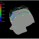 뇌파(EEG, Electroencephalogram) 개요 이미지