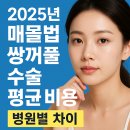 2025년 매몰법 쌍꺼풀 수술 (비절개) 평균 비용과 병원별 차이